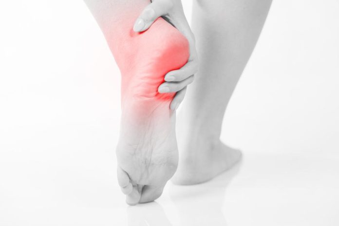 how to cure plantar fasciitis in one week