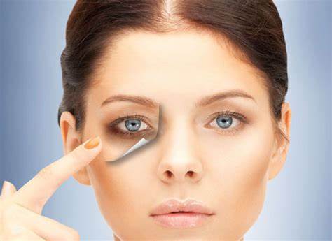 how to get rid of dark circles under eyes