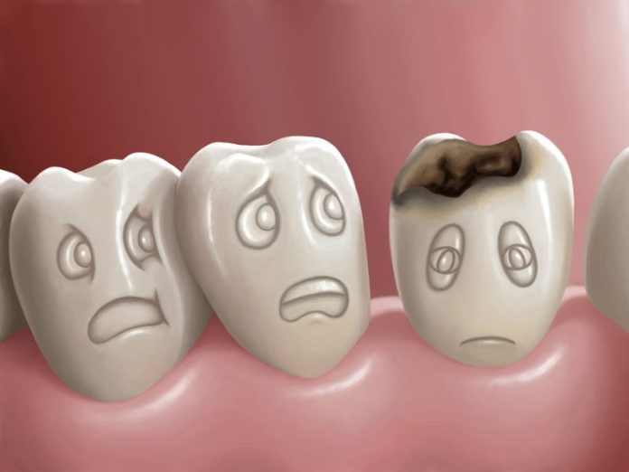 How To Know If You Have A Cavity?
