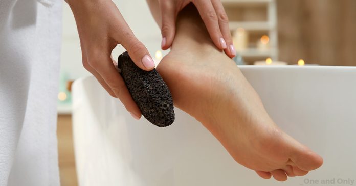 how to remove thick dead skin from feet