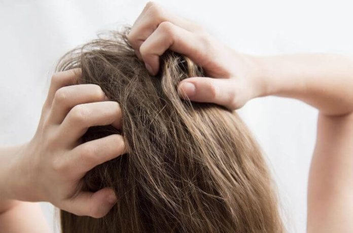 How To Remove Nits From Hair Without A Comb?